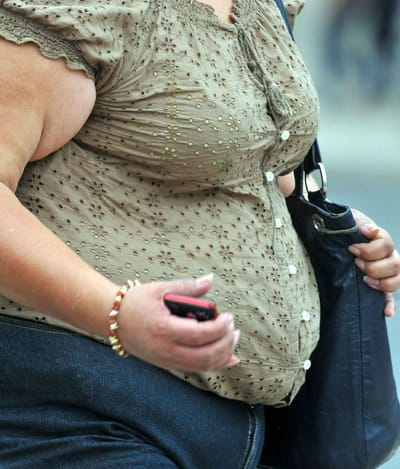 Obesidad mórbida afecta más a mujeres. (Foto tomada de diariodenavarra.es)
