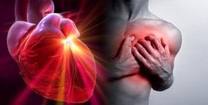 Enfermedades cardiovasculares van en aumento. (Foto tomada de http://cartasdesdecuba.com).