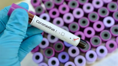 Coronavirus. Con fines ilustrativos. (Foto:Internet)