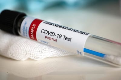 Prueba COVID-19 .Con fines ilustrativos. (Foto:Internet)