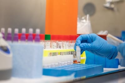 Prueba laboratorio para detectar COVID-19, foto con fines ilustrativos (Foto:Internet)