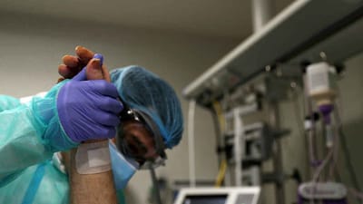 Pacientes graves con COVID-19. Con fines ilustrativos. Foto:Internet.
