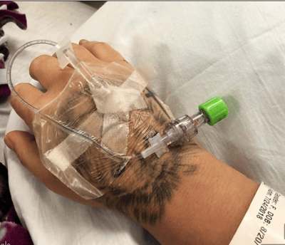 Imagen tomada del adelanto de YouTube, donde aparece la mano de Lovato llena de tubos, mientras estuvo hospitalizada.