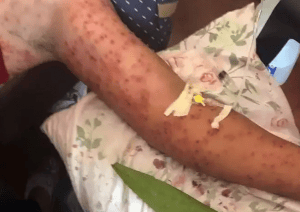 Víctima de las abejas. Tomada de Internet. 