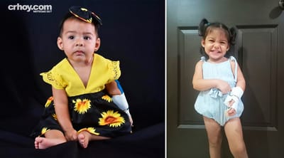 Alaia actualmente tiene 2 añitos y requiere de una cirugía en su brazo, esto luego de una presunta mala praxis médica que sufrió al nacer.
