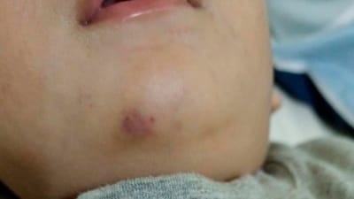 Al menos 5 familias acusan a centro educativo en Moravia por presunta agresión a sus hijos