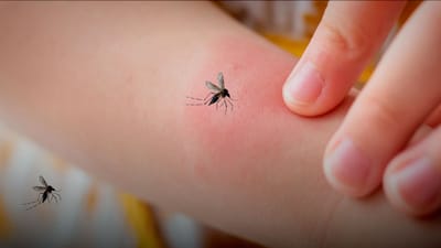 El virus Shamonda afecta principalmente al ganado y se transmite mediante la picadura de insectos infectados.