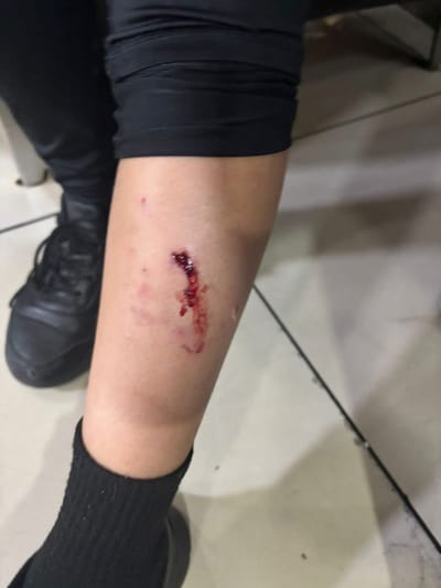Perro mordió al menor en una pierna.