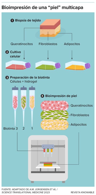 Los conceptos básicos de la impresión de sustitutos cutáneos incluyen: la obtención de células; el cultivo de dichas células; la creación de una tinta; y la impresión de la 