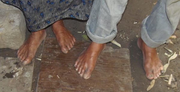 Dicen que son descalzos porque no les gustan los zapatos...