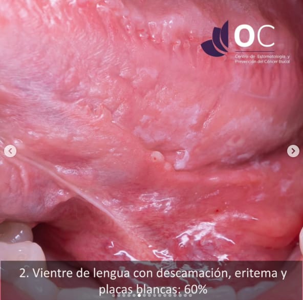 Carousel image
